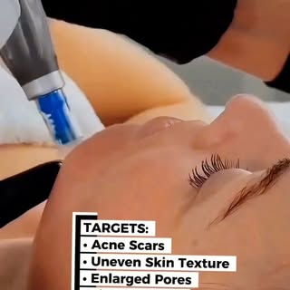 Healthy, confident skin begins with the right care.

Whether you're dealing with acne scars, enlarge