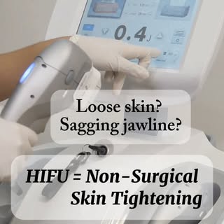 If you're noticing loose skin, a sagging jawline, or a mild double chin, HIFU offers a non-surgical 