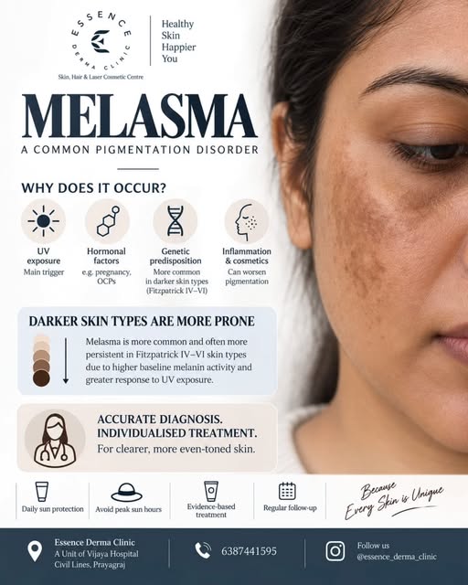 Pigmentation that doesn’t fade? It may be melasma. 🤎

UV exposure, hormones & genetics can all play