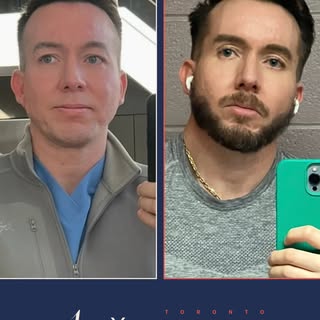 Could you tell this beard was transplanted?

These photos were submitted by a patient approximately 