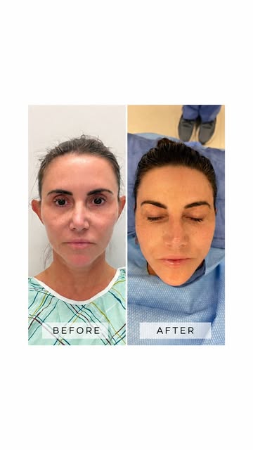 Cosmetic procedures are absolutely wants, not needs, and they certainly aren’t for everyone. But I a