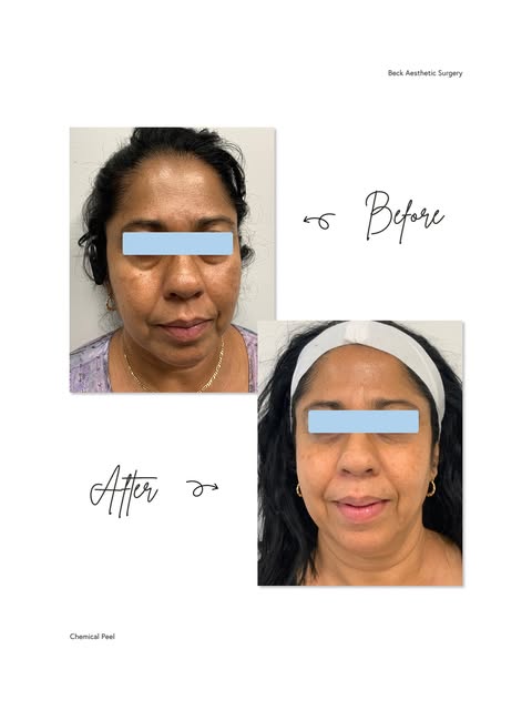Every patient’s skin tells a different story.

She came in with texture, uneven tone, and years of s