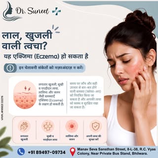 ✨ लाल, खुजली और जलन वाली त्वचा को नज़रअंदाज़ न करें।
समय पर सही उपचार से अपनी त्वचा को स्वस्थ रखें। 
