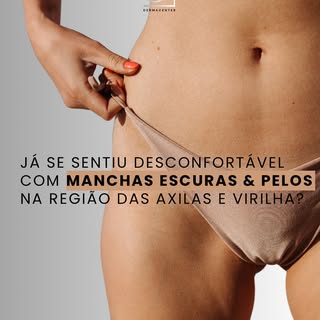 Axilas e virilha lisinhas e livres de manchas com o Protocolo de Clareamento Método Summer! ✨ 
Usand