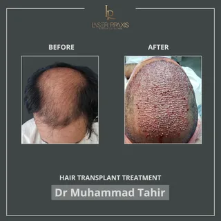 Some transformations don’t require filters, explanations, or exaggeration.

Just surgical expertise,