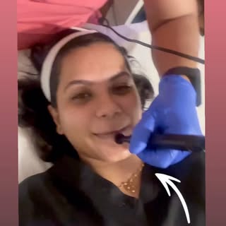 RF Skin Tightening ✨

A gentle, consistent approach to aging well.

Radiofrequency (RF) works by del