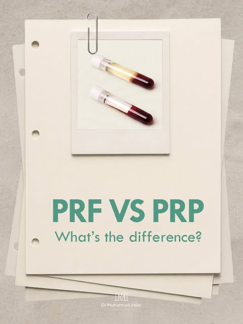 PRF vs PRP ….What’s the Difference?