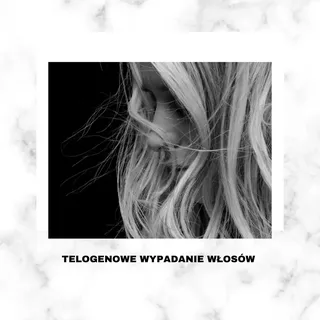 Telogenowe wypadanie włosów: kluczowe zaadnienie w trychologii! 

Telogenowe wypadanie włosów to naj