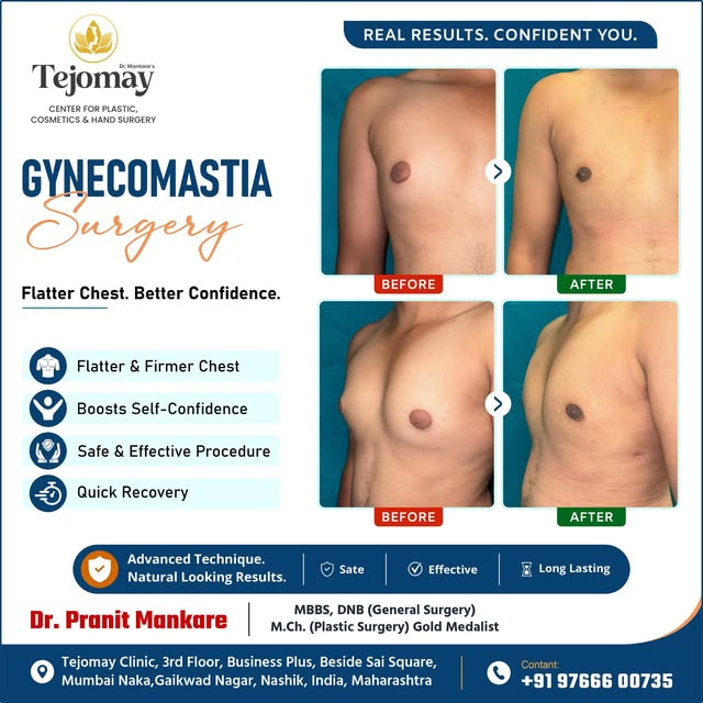 ✨ Flatter Chest. Better Confidence. ✨

Gynecomastia can affect both physical appearance and self-con