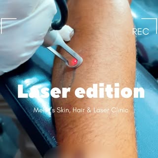 Lasers for every need🔽

🔹Tattoo
🔹Pigmentation
🔹Dull skin/uneven tone
🔹Scars
🔹Open pores
🔹Hair