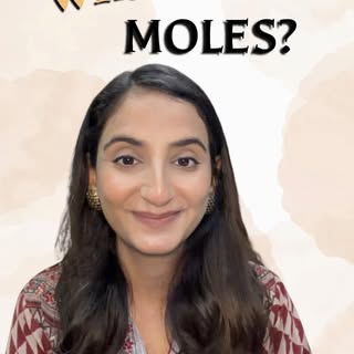Moles: what are they and ways to treat them! 

#drmehatyagi #dermatologist #dermatologistofghaziabad