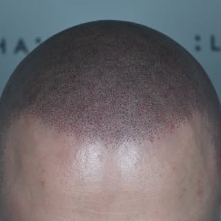 • Vælg rigtigt • Vælg kvalitet • Vælg illuhair •

Der er SMP og så er der illuhair🥇

Kunden her øns