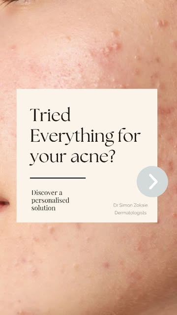 Acne Isn’t Just Acne. Your Skin Needs the Right Diagnosis.

Acne can look different from person to p