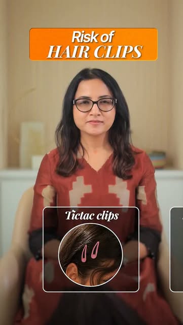 Hair Accessories: Good vs Bad for Your Hair

#HairTips #HairFall #TractionAlopecia #HealthyHair #Hai