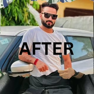 Confidence restored at Apex Hair Transplant & Skin! 💇‍♂️✨ Say hello to a fuller, natural look. #Hai