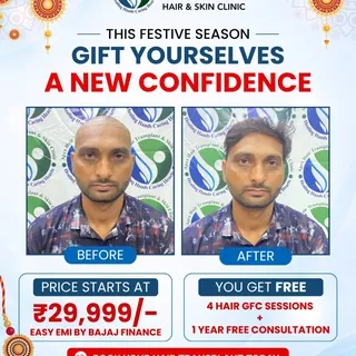Confidence looks good on you. ✨ 

This festive season, gift yourself a fresh start with a hair trans