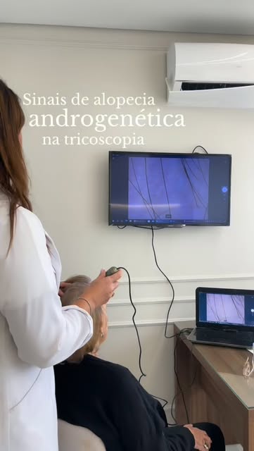 Nem sempre a alopecia androgenética começa com uma falha visível. 

Na tricoscopia, conseguimos iden