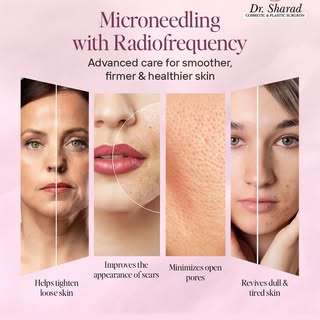 Transform your skin with advanced RF Microneedling! 

The ultimate care to tighten loose skin, reduc
