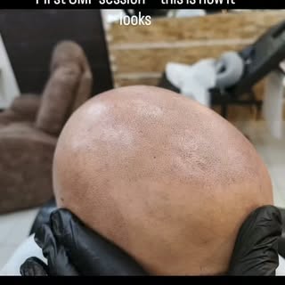 First Session Result

A natural SMP transformation starts with the foundation.

This is how the scal