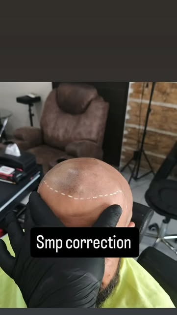 Fixing someone else’s SMP today. Softened the hairline, corrected the tone, and gave him clean, natu
