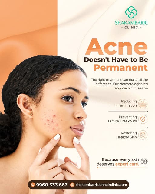 Acne doesn’t have to be a permanent part of your skin story. 

Acne can affect your skin long after 