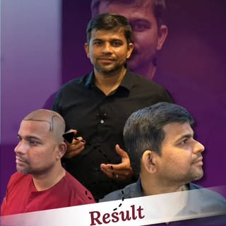 प्रेझेंटेशन उत्तम झालं होतं, पण लोकांनी सांगितलं — “लुक्सवर काम कर, केस गळत आहेत.” तेव्हा समजलं की प