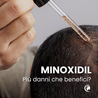 “Prendi il Minoxidil, a me ha aiutato tanto!”

Leggo spesso online consigli dati con troppa leggerez
