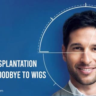 Baldness is a universal concern that has been bothering many people throughout the ages. Most of the