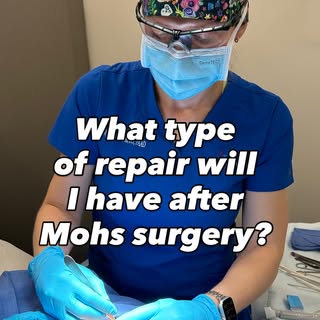 “What type of repair will I have after my Mohs surgery?” is a really common question that I get aske