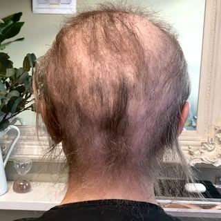 5 REASONS WHY I SHAVE MY HEAD

1) There is a huge misconception that if you shave your head, your ha