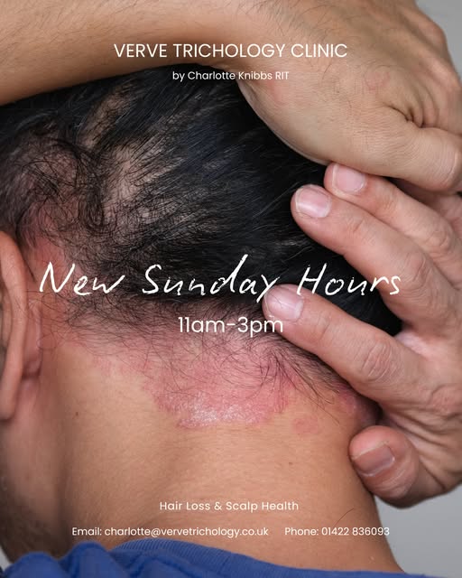 📢 Sunday Trichology Appointments Now Available 

Verve Trichology Clinic is now open on Sundays fro