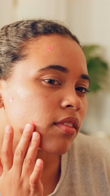 Acne Marks vs Acne Scars — क्या आपके चेहरे पर सिर्फ marks हैं या actual acne scars? 🤔

Pimples ठीक 