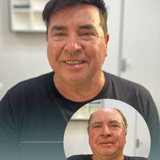 RESULTADOS QUE FALAM POR SI.

Próteses capilares masculinas desenvolvidas e aplicadas com foco em na