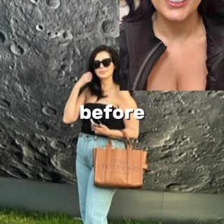 Our beautiful patient was already glowing—but after 5 months of Semaglutide weight loss shots, Daxxi