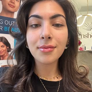 ✨ Plump, defined, and natural ✨

Our client’s gorgeous transformation shows how subtle lip filler ca