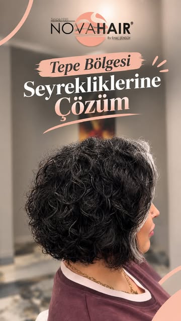 Kadınlarda tepe bölgesindeki seyrelmeler kader
değil.
Tepe bölgesine özel tasarım ile doğal, hacimli