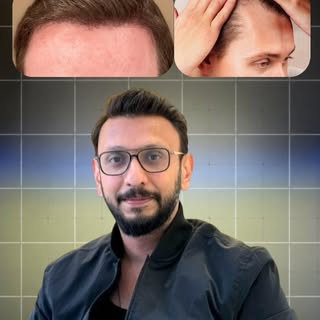 Comment “DOCTOR” and I’ll send you the first 3 things I’d personally check for early hair loss.

Hai