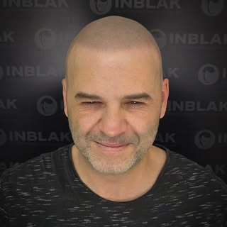 💬 Cada persona tiene su estilo y la micropigmentación debe acompañarlo.
Rapado uniforme, línea fron