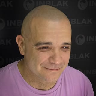 🧩 Cada cabeza tiene su propio mapa, y cada diseño debe adaptarse a él.
La piel, la tonalidad, la fo