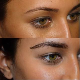 Eyebrows are the most defining feature on the face - hair loss there can cause your face to lose sha