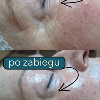 Umow wizytę przez booksy: magier.booksy.com lub zadzwoń 535 412 877
MAGIER kosmetologia I trychologi