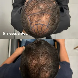 Com apenas 6 meses, já é possível perceber uma grande transformação.

Mas existe um detalhe que muit