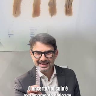 Na cirurgia de transplante capilar, um detalhe pode mudar completamente o resultado: **a forma como 