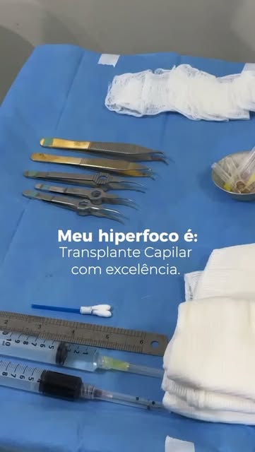 Quando me perguntam qual o meu "hiperfoco", eu só consigo pensar em transplante capilar. 

Estudar c