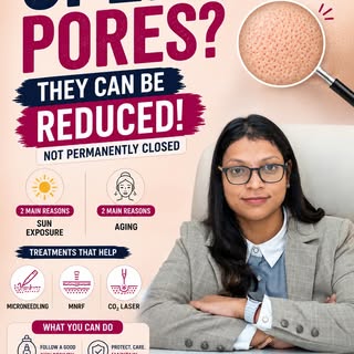 Open Pores Treatment in Indirapuram

Open pores are a very common skin concern and are present in ev