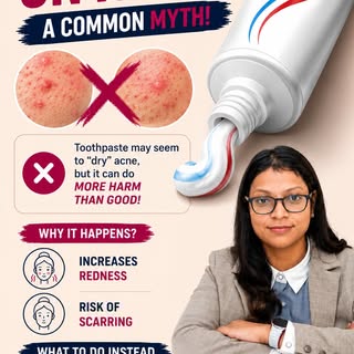 Stop Using Toothpaste on Pimples!

Is toothpaste really a quick fix for pimples?

Many people believ