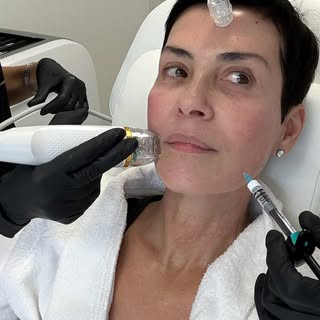 @drlucasplasticsurgery me revoilà ! 🥼
Il y a quelques mois, je vous avais partagé mon rdv dans la c