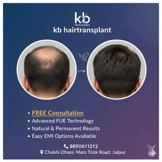Hair Transplant in Jaipur

Best Hair Transplant Clinic Jaipur

Beard Transplant Jaipur

PRP Hair Tre