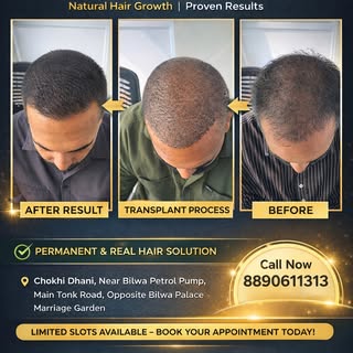 Hair Loss se Pareshan? Solution Jaipur mein hi hai!

Cap, wig ya hesitation chhodiye.
Get Natural Ha