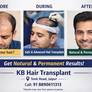 Tired of hair thinning or patches?
KB Hair Transplant Jaipur mein paayein
👉 Natural looking results